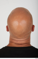  Photos Bobby Hyde bald head 0005.jpg